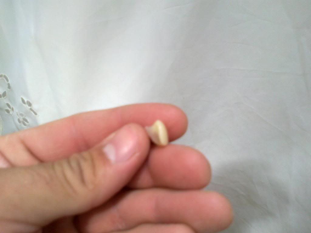 protesis dental casera protesis dental casera